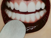 dentition 75016